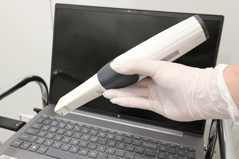 口腔内スキャナー