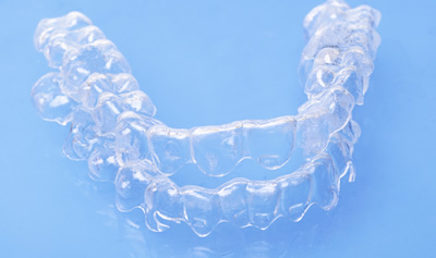 インビザライン